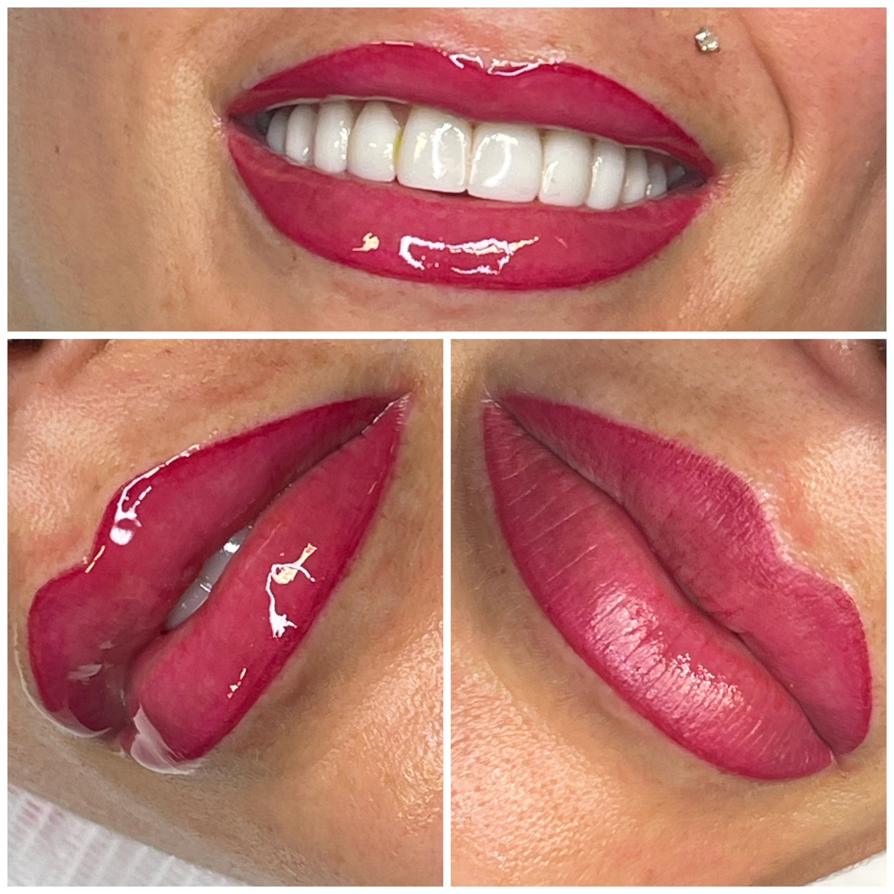 What is a Lip Tattoo? - Process, Sessions, Cost